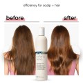 شامپو ضدشوره میلک شیک purifying blend