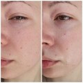 ژل کرم ضدآفتاب آبرسان SPF50+ هیالورونیک اسید مناسب پوست مختلط و چرب ایزنتری Hyaluronic Acid Watery Sun Gel حجم 50 میل