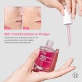 سرم ضد لک و روشن کننده مناسب پوست‌های کدر آنوا Niacinamide 10% + TXA 4% آنوا | ANUA Spot Correcting Serum حجم 30 میل