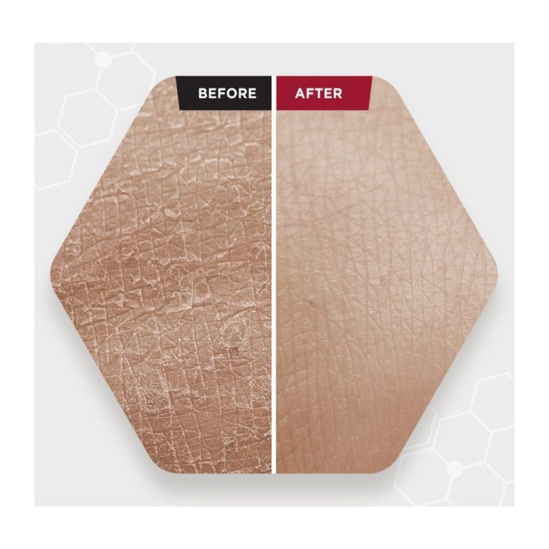 سرم لایه بردار قوی پیلینگ و ضد جوش مناسب انواع پوست اسکین ۱۰۰۴ اسکین ۱۰۰۴ | SKIN1004 Zombie Beauty Bloody Peel حجم 30 میل