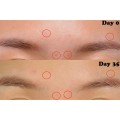 سرم ضد لک شفاف کننده مناسب پوست‌های مستعد جوش اکسیس وای | AXIS-Y A AXIS-Y Dark Spot Correcting Glow Serum حجم 50 میل