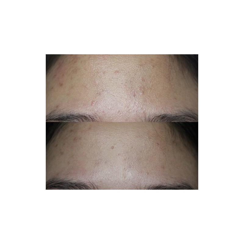 سرم ضد لک شفاف کننده مناسب پوست‌های مستعد جوش اکسیس وای | AXIS-Y A AXIS-Y Dark Spot Correcting Glow Serum حجم 50 میل