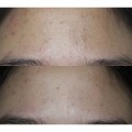 سرم ضد لک شفاف کننده مناسب پوست‌های مستعد جوش اکسیس وای | AXIS-Y A AXIS-Y Dark Spot Correcting Glow Serum حجم 50 میل