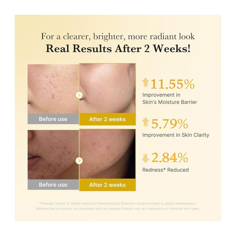 سرم ضد لک و روشن کننده مناسب پوست های کدر و دارای لک مدی کیوب Kojic Acid Turmeric Niacinamide Serum حجم 30 میل