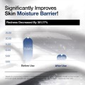 کرم مرطوب‌کننده با ۳ سراماید و پانتنول مناسب پوست‌های خشک آنوا Ceramide Panthenol Moisture Barrier Cream حجم 100 میل