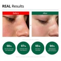 کرم آبرسان با سیکا و نیاسینامید مناسب پوست‌های حساس و مستعد آکنه دکتر جی Dr.G Red Blemish Clear Soothing Cream  حجم 70 میل