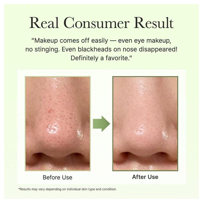 بالم پاک‌کننده عمقی منافذ با فیتو PDRN و آنزیم مناسب پوست چرب و مختلط آرنسیا Pore Melt Cleansing Balm حجم 90 میل