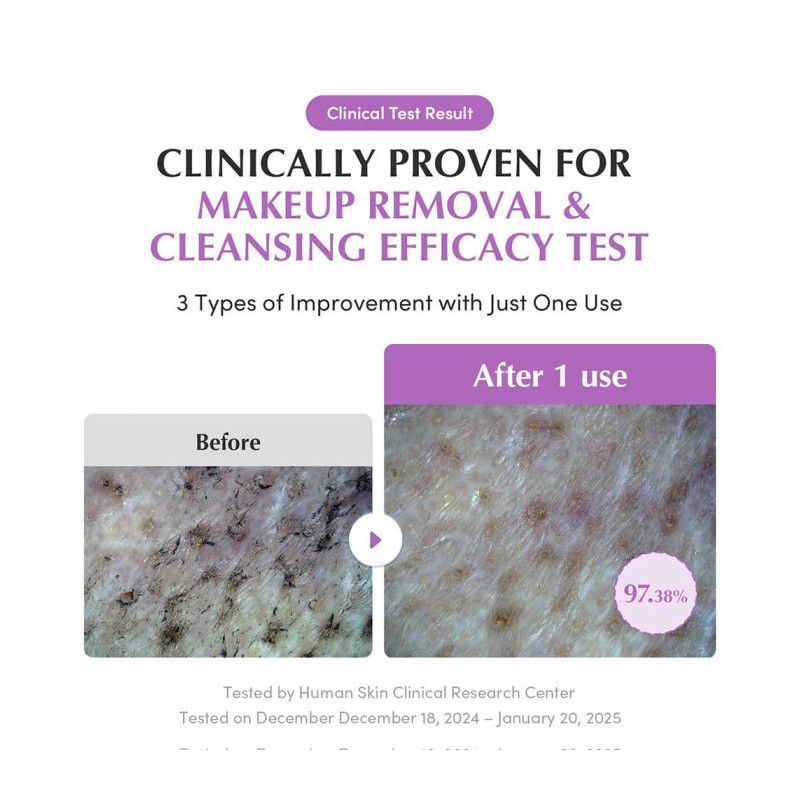 شوینده روغنی کنترل منافذ مناسب پوست چرب و مختلط اکوال بری EQQUALBERRY Purple Rice Pore Smoothing Cleansing Oil حجم 200 میل