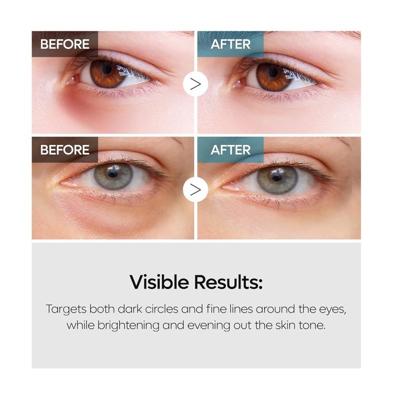 کرم دورچشم روشن‌کننده و ضدچروک مناسب انواع پوست دکتر ملاکسین Dr.Melaxin TX Retinalsome Double Effect Eye Cream حجم 40 میل