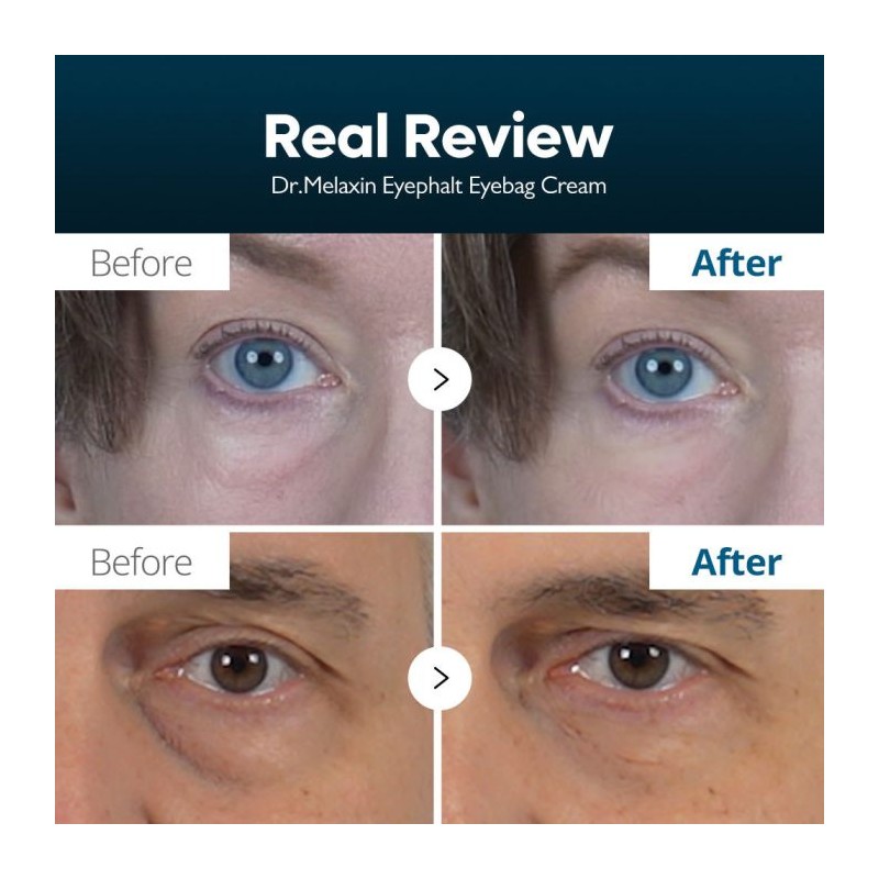 کرم دور چشم روشن‌کننده و ضدچروک مناسب پوست کدر و دارای چروک دکتر ملاکسین Dr.Melaxin Eyephalt Eyebag Cream حجم 10 میل