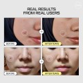 اسنس آبرسان حلزون و پپتید مناسب انواع پوست جومیسو Snail Mucin 95 + جومیسو | Jumiso Peptide Essence حجم 140 میل