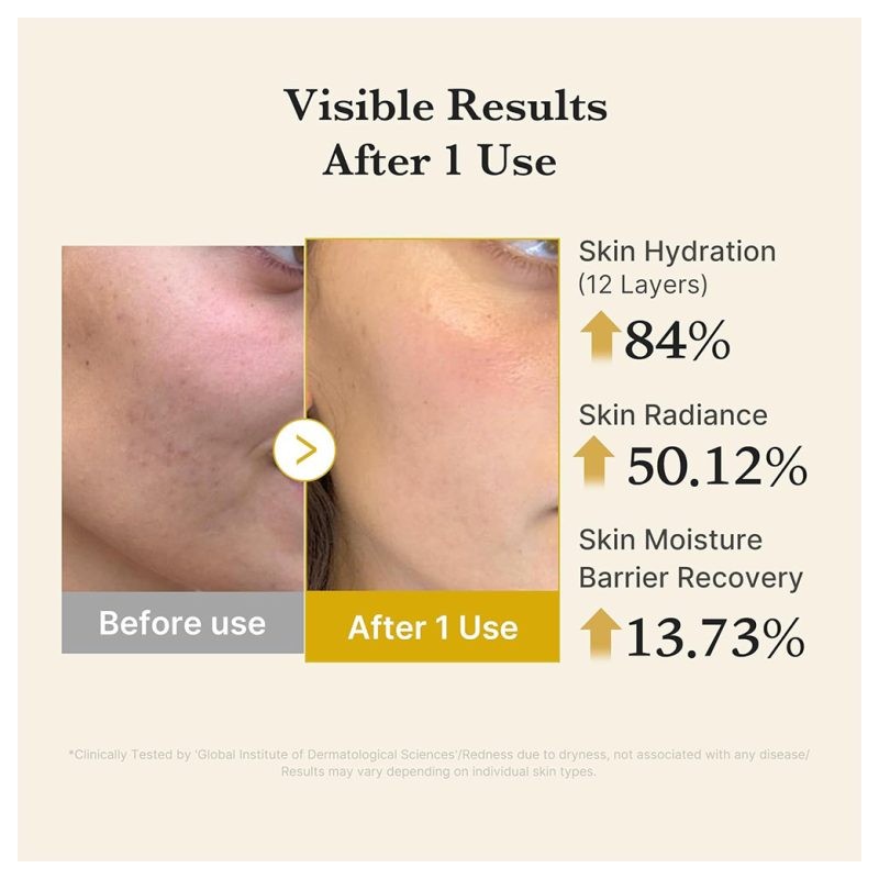 میست سرم ژلی روشن‌کننده مناسب پوست کدرودهیدراته مدی کیوب Medicube Kojic Acid Turmeric Vita Jelly Mist Serum حجم 100 میل