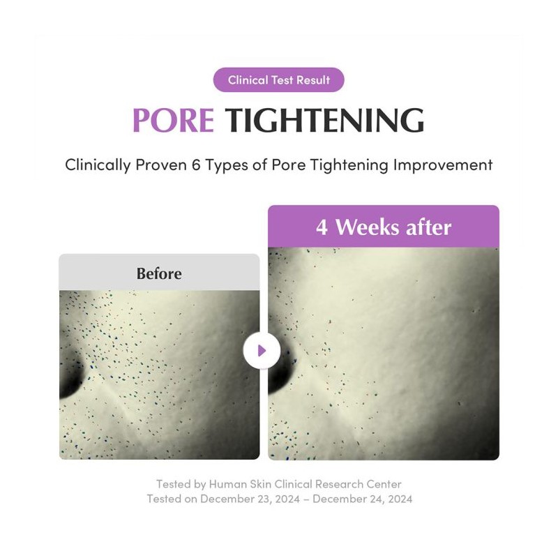 سرم کنترل منافذ با اسیدهای لایه‌بردار مناسب پوست چرب و مختلط اکوال بری EQQUALBERRY Purple PDRN Pore Minimizing Serum حجم 30 میل