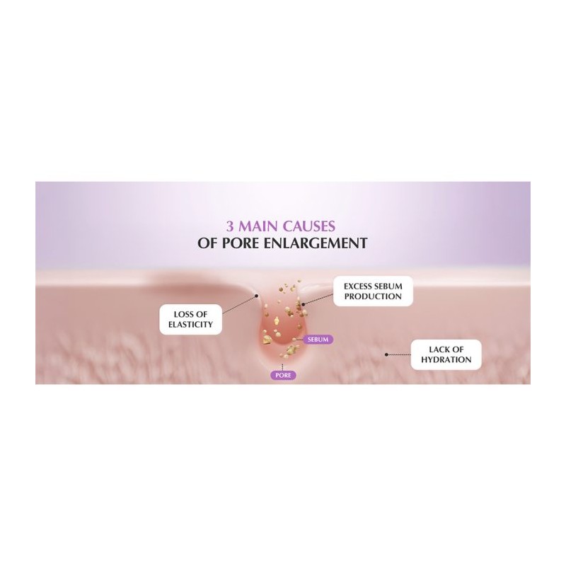سرم کنترل منافذ با اسیدهای لایه‌بردار مناسب پوست چرب و مختلط اکوال بری EQQUALBERRY Purple PDRN Pore Minimizing Serum حجم 30 میل