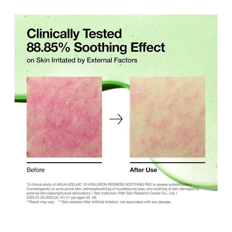پد تونر ضد جوش آزلائیک اسید 10 درصد مناسب پوست حساس آنوا آنوا | ANUA Azelaic 10 Hyaluron Redness Soothing Pad حجم 230 میل