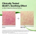 پد تونر ضد جوش آزلائیک اسید 10 درصد مناسب پوست حساس آنوا آنوا | ANUA Azelaic 10 Hyaluron Redness Soothing Pad حجم 230 میل