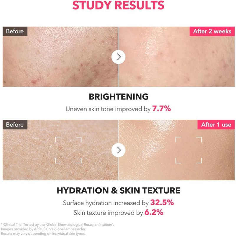 تونر میلکی ترانگزامیک اسید و نیاسینامید آپریل اسکین ضد لک و روشن کننده قوی پوست APRILSKIN TXA Niacinamide 99 Milky Toner
