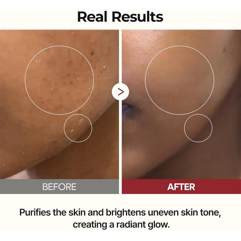 تونر پیل شات برنج دکتر ملاکسین لایه بردار و روشن کننده پوست Dr.Melaxin Peel Shot Glow White Rice Toner