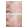 کرم مرطوب کننده پوست خشک و خیلی خشک سراوی CeraVe Moisturizing Cream For Dry To Very Dry Skin - 454-%da%af%d8%b1%d9%85