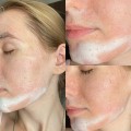 فوم شستشوی صورت سراوی مخصوص پوست نرمال تا چرب Cerave Foaming Cleanser For Normal To Oily Skin 87ml - 236-%d9%85%db%8c%d9%84%db%8