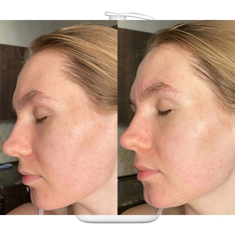 فوم شستشوی صورت سراوی مخصوص پوست نرمال تا چرب Cerave Foaming Cleanser For Normal To Oily Skin 87ml - 236-%d9%85%db%8c%d9%84%db%8