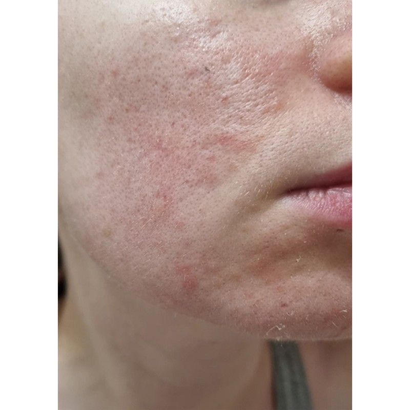کرم ترمیم کننده سیکاپلاست لاروش پوزای La Roche Posay Cicaplast Baume B5 - 100-%d9%85%db%8c%d9%84%db%8c-%d9%84%db%8c%d8%aa%d8%b1