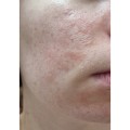 کرم ترمیم کننده سیکاپلاست لاروش پوزای La Roche Posay Cicaplast Baume B5 - 100-%d9%85%db%8c%d9%84%db%8c-%d9%84%db%8c%d8%aa%d8%b1
