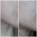 کرم مرطوب کننده و تغذیه کننده صورت و بدن اتودرم بایودرما مناسب پوست خشک Bioderma Atoderm Cremes Day Cream - 200-%d9%85%db%8c%d9%