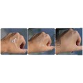 کرم ضد چروک و جوانساز کمپلکس 9 پپتاید پرو مدی پیل Medi-Peel Peptide 9 Volume Tox Cream PRO