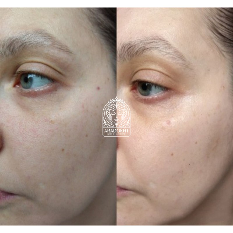 کرم ضد چروک و جوانساز کمپلکس 9 پپتاید پرو مدی پیل Medi-Peel Peptide 9 Volume Tox Cream PRO