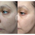 کرم ضد چروک و جوانساز کمپلکس 9 پپتاید پرو مدی پیل Medi-Peel Peptide 9 Volume Tox Cream PRO