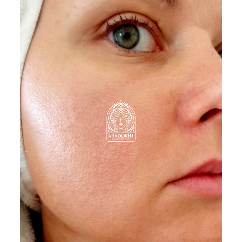 کرم ضد چروک و جوانساز کمپلکس 9 پپتاید پرو مدی پیل Medi-Peel Peptide 9 Volume Tox Cream PRO